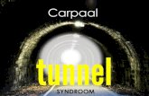 Carpaal tunnel syndrome