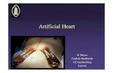 Bart Meyns_artificial heart