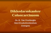 Dikkedarmkanker Coloncarcinoom Dr. B. Van Overberghe Sint-ElisabethziekenhuisZottegem.
