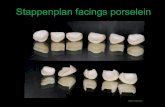 Facings en kronen tanden porselein, stappenplan. Kliniek voor Cosmetische Tandheelkunde,