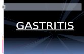 Gastritis   úlcera