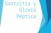 Gastritis y úlcera péptica