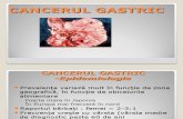 Cancerul Gastric