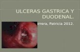 Ulceras Gastrica y Duodenal