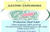 GASTRIC CARCINOMA Professor Ravi Kant FRCS (England), FRCS (Ireland), FRCS(Edinburgh), FRCS(Glasgow), MS, DNB, FAMS, FACS, FICS, Professor of Surgery.