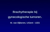 Brachytherapie bij gynecologische tumoren.