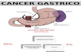 CANCER GASTRICO.ppt