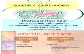 1gastric Carcinoma