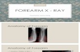 Forearm X - Ray_DMI14042309