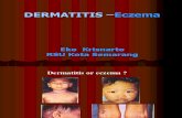 Dermatitis & Eczema 2007