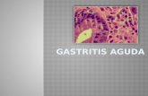 Gastritisaguda 110811231604-phpapp01