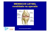 meniscusletsels na operatie - Groningen Sport · PDF file Meniscusletsel revalidatie na operatie partieel verwijdering • 0 – 4 wk 1e fase postoperatief • Onmiddellijke steunname