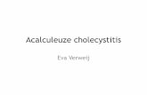 Acalculeuze cholecystitis - Startintensivistenopleiding.nl/downloads-25/files/Acalculeuze... · • Overname voor CABG > spoed ivm recidief klachten • Post-CABG cardiogene shock: