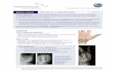 AFD HANDCHIR PROTOCOLLEN MED | Pages 09 | …afdelinghandchirurgie.nl/wp-content/uploads/2014/11/...MED-v1.pdf · Fractures of the base of the ﬁrst metacarpal: current treatment