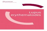 Lupus erythematodes - ReumaLierreumalier.be/PDF-FILES/Systemische_Lupus_erythematodes_(RF).pdf · Nieren Nierontsteking (nefritis) komt bij systemische lupus ook regelmatig voor.