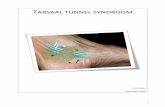 TTAARRSSAAAALL TTUUNNNNEELL SSYYNNDDRROOOOMMpodologiedommelen.nl/userfiles/downloads/Het tarsale tunnelsyndroom wordt in de... · De n. tibialis posterior loopt samen met de bloedvaten.