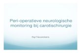Peri-operatieve neurologische monitoring bij carotischirurgie · Peri-operatieve neurologische monitoring bij carotischirurgie Sigi Nauwelaers. Inleiding ... Circulus van Willis.