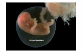vruchtwater - neonatologie.ugent.be · 1. vnl. bepaald door uteriene tonus , meer dan door intra-uterien volume . 2. neemt toe bij vorderende zwangerschap: plateau vanaf 2 de trimester.