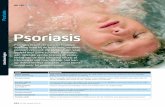 Psoriasis - padbergkliniek.nl · Psoriasis unguium (bij 25-50%) Psoriasis die zich ook uit in de nagels in de vorm van putjes in de nagelplaat, oranje-gele vlekken onder de nagel