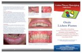 Orale Lichen Planus · 2 3 4 Inleiding Lichen Planus (LP) komt voor op de huid, behaarde hoofdhuid, nagels en mucosa. De mucosale vorm is beschreven ter plaatse van de mond, de slokdarm,