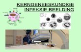 KERNGENEESKUNDIGE INFEKSIE BEELDINGlearning.ufs.ac.za/INTERNAL_MEDICINE_ON/Resources/3. ACADEMIC RESOURCES/2. MBCHB...Kerngeneeskundige Infeksie beeldings • Opsporing van infeksie