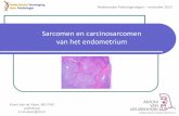 Sarcomen en carcinosarcomen van het endometrium · 2019-10-10 · Sarcomen en carcinosarcomen van het endometrium Koen Van de Vijver, MD PhD patholoog k.vd.vijver@nki.nl Nederlandse