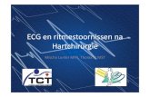 ECG en ritmestoornissen na Hartchirurgie - M_ Lunter - ECG en ritmestoornissen post... · PDF file ECG • Elektrocardiografie = bestuderen van elektrische activiteit van het hart