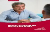 BRACHYTHERAPIE BIJ PROSTAATKANKER · 2020-03-19 · Hoofdstuk 1 Brachytherapie bij prostaatkanker 4 Hoofdstuk 2 Voor de behandeling van start gaat 6 ... nacht moet er iemand bij u