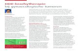 HDR-brachytherapie bij gynaecologische tumoren · MRI-scan de positie van de applicator tegenover het doelvolume en sluit hij een mogelijke perforatie uit. Pas dan kan het bestralingsplan