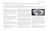 The metaconule in the human upper molars · 2013-07-16 · Volumen 15 Nº 2 Supl. 1 2007 38 El metaconulo de los molares superiores humanos The metaconule in the human upper molars
