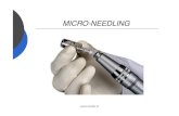 MICRO-NEEDLING - Injectables Tilburg · De micro-needling behandeling heeft voordelen maar is ook een gelimiteerd in het uiteindelijke te behalen resultaat. Hoe meer de huid is beschadigd