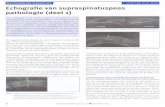 Echografie van supraspinatuspees pathologie (deel 1) · 2019. 3. 6. · T. GEERTSMA EN M. MAAS Echografie van supraspinatuspees-pathologie (deelt) Figuur 1. Sagittale (links) en transversale