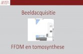 FFDM en tomosynthese - LRCB · 2017. 3. 13. · Siemens Novation: 3 kleine sensoren Siemens Inspiration: segmentatie Philips Mammomat: segmentatie Philips Microdose: 8.0 x 16.0 cm