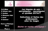 Les biopsies du sein : B Scheuer-Niro microbiopsies ... ST...Modes de guidage: type et visibilité du signal Microcalcifications 97% des macrobiopsie sous stéréotaxie Mammographie
