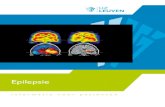 Epilepsie - UZ Leuven · 2020. 1. 17. · WAT IS EPILEPSIE? EPILEPSIE: EEN ‘KORTSLUITING’ Om te begrijpen wat epilepsie is, moeten we wat inzicht hebben in de werking van onze