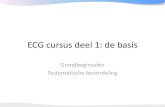 ECGpedia ECG cursus · 2008. 11. 3. · •te lang AV blok QRS duur