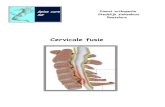 aangepast cervicaal fusie - Orthopedie Roeselare · 2019. 4. 2. · Cervicale fusie. 1. Anatomie van cervicale wervelkolom Vanuit de hersenen loopt ons ruggenmerg als een buis naar