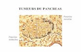 TUMEURS DU PANCREAS - college-chirped.fr