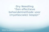 Dry Needling â€œEen effectieve behandelmethode voor (myofasciale) liespijnâ€‌ Brigitte Dooren, Fysiotherapeut, Orthopedisch Manueel Therapeut, Dry Needling